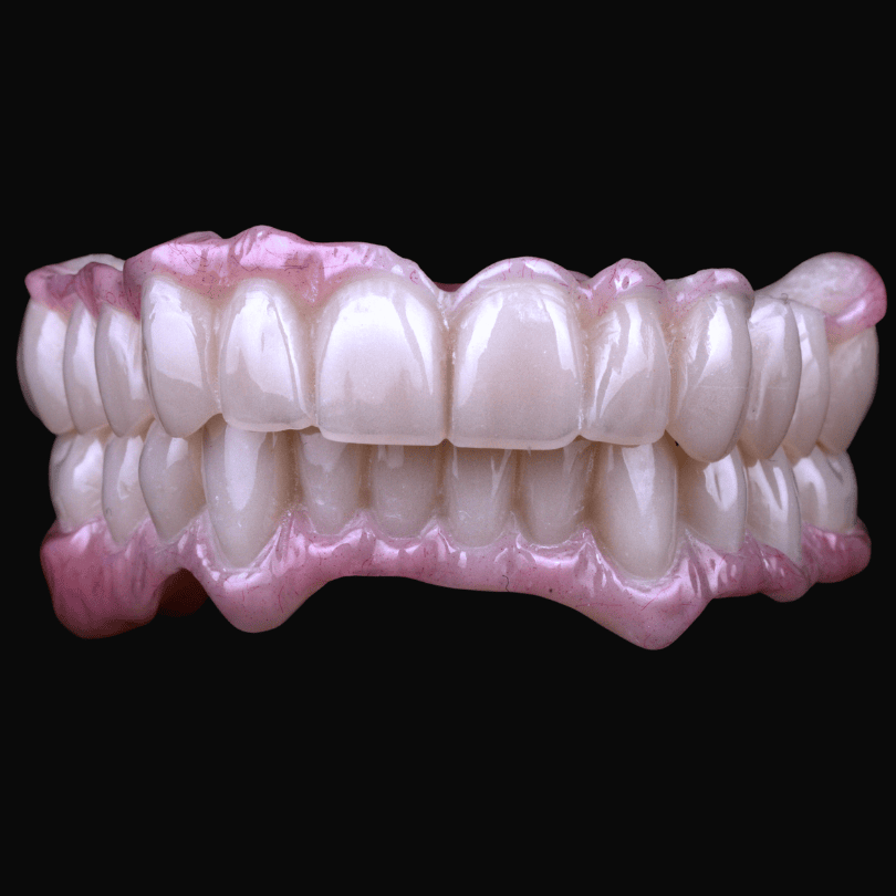 Temporary fixed dentures offer secure short-term tooth replacement while final restorations are set.